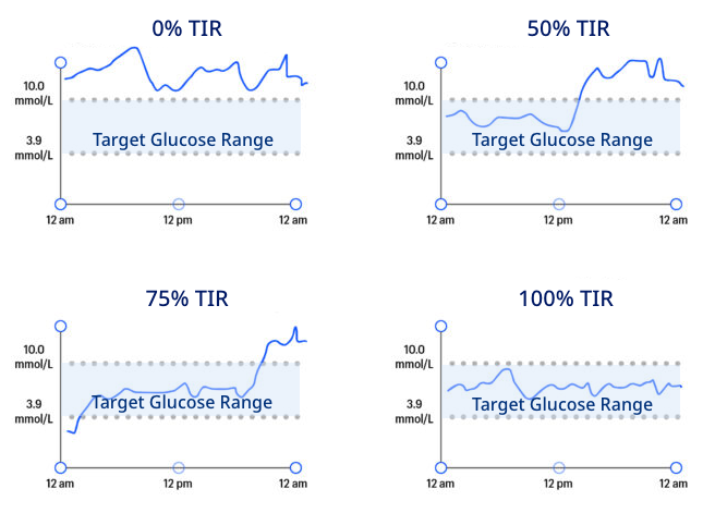 Examples of four Time in Range readings