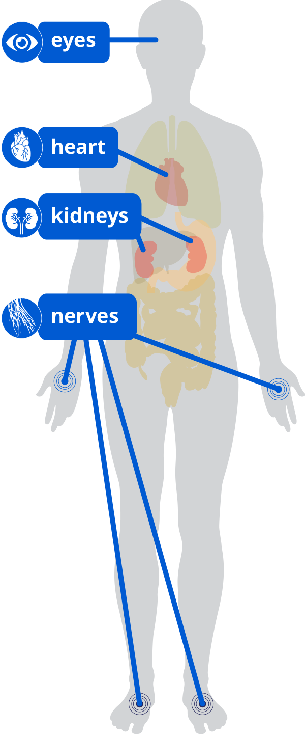 Diabetes body graphic