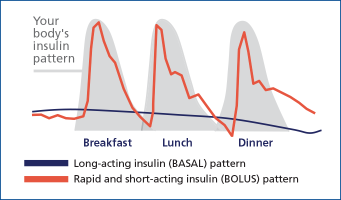 Body's insulin pattern graphic